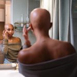 Understanding Alopecia in Black Women: What an Expert Wants You to Know